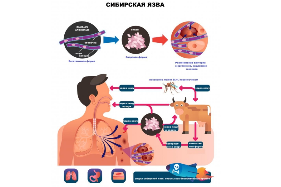 Сибирская язва, причины возникновения и последствия.